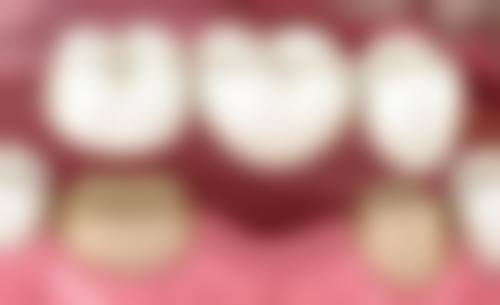 二、苏州洁瑞口腔医生团队，打造专精诊疗服务