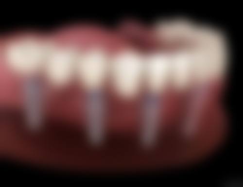 七、正丰口腔门诊部就医指南，便捷就诊不迷路