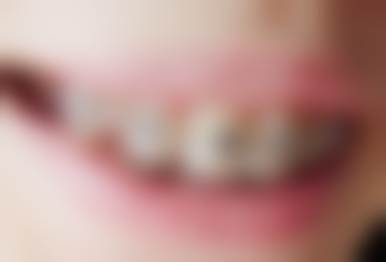 二、榆林启慧口腔(文化路门诊部)医生团队,打造专精诊疗服务