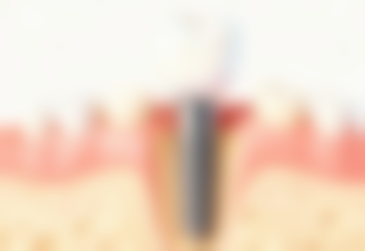 七、佛山顺德陈村微笑口腔门诊部就医指南，便捷就诊不迷路