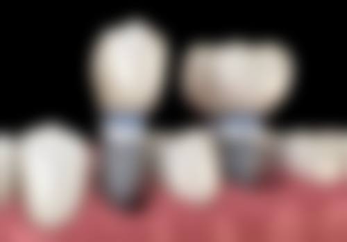 七、武汉大众口腔(京汉大道店)就医指南,便捷就诊不迷路