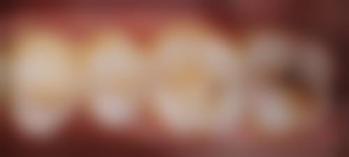 二、深圳新齿泰口腔门诊部医生团队，打造专精诊疗服务