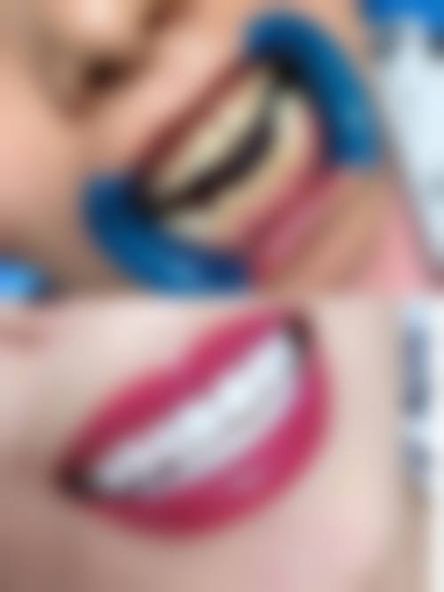 四、南宁洋紫荆口腔门诊(茶花园分店)设备介绍