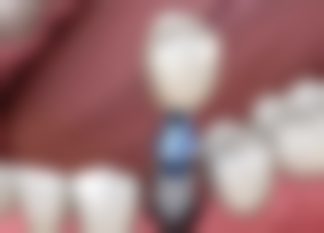 七、九江濂溪奇洋口腔就医指南，便捷就诊不迷路