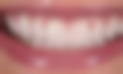 三、桂林忠爱口腔门诊部核心科室与特色项目