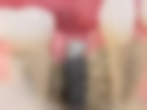 四、西安泰康拜博朱雀口腔门诊部设备介绍