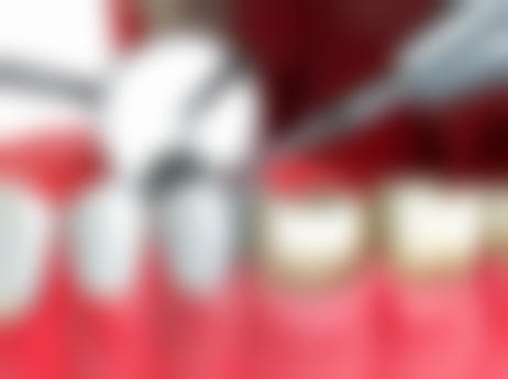 四、十堰从兵口腔(北京南路分院)设备介绍