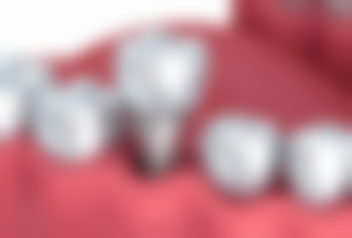 七、湖北襄阳成虎口腔就医指南，便捷就诊不迷路