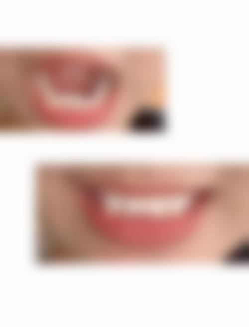 四、北京蜗牛亲子口腔诊所设备介绍