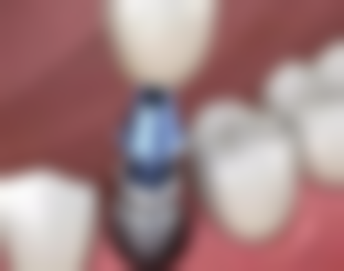 三、河北衡水安平县华姿口腔核心科室与特色项目