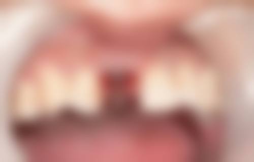 五、佛山曙光精齿口腔(惠景分院)舒适就医环境，打造人性化诊疗体验