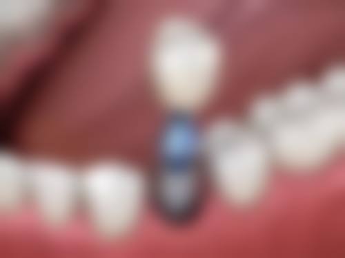 二、秦皇岛致美口腔医生团队,打造专精诊疗服务
