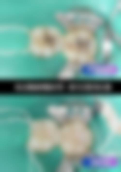 四、襄阳天恩口腔医院设备介绍