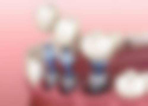 四、山东烟台栖霞博仁口腔设备介绍