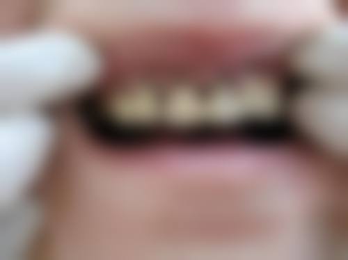 七、广东惠州致雅口腔就医指南，便捷就诊不迷路