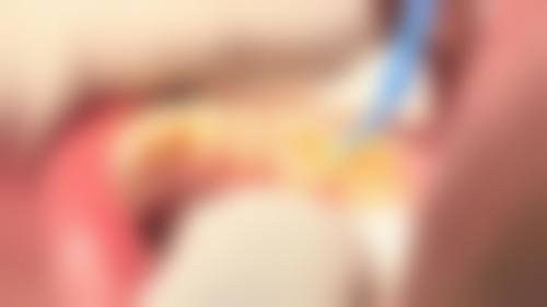 七、重庆云阳县六个牙口腔诊所就医指南，便捷就诊不迷路