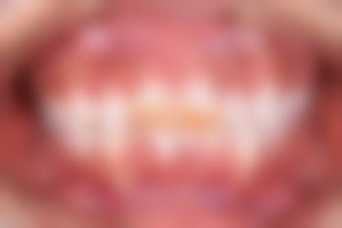 医生资质介绍：成都龙泉驿康美雅口腔诊所张伟娜靠谱吗