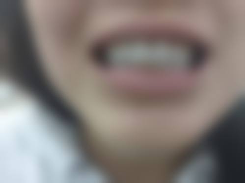 FAQ：关于成都龙泉驿康美雅口腔诊所张伟娜的常见疑问