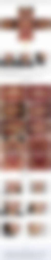 擅长项目详解：成都龙泉驿康美雅口腔诊所张伟娜擅长什么