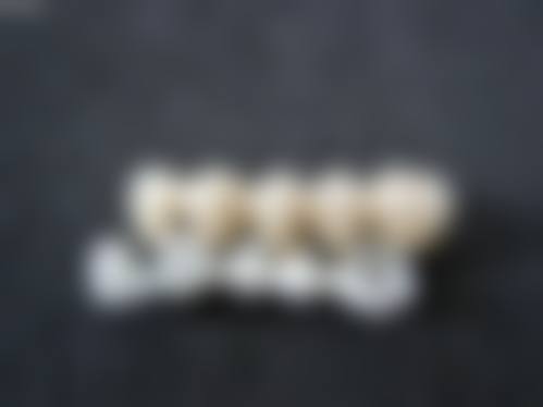 预约优惠活动:郑州乐帆口腔门诊部杨金锋
