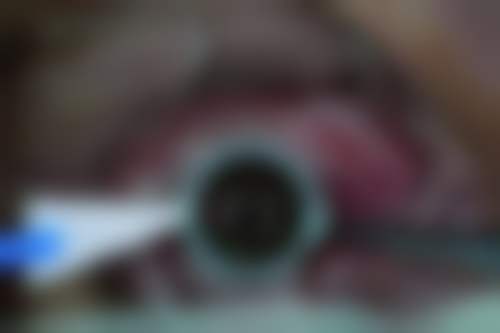 预约优惠活动:有没有隐藏限制?