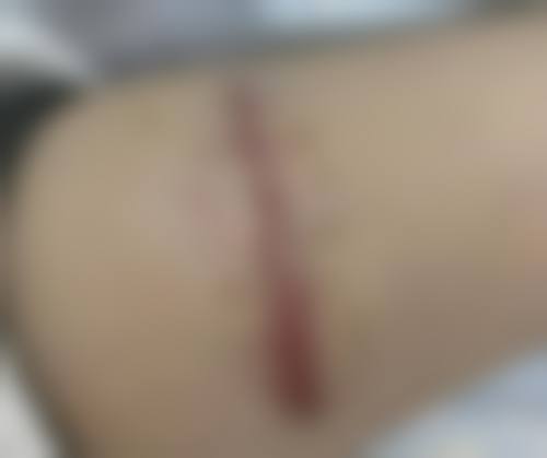 价格透明与优惠活动：高性价比享受专精服务