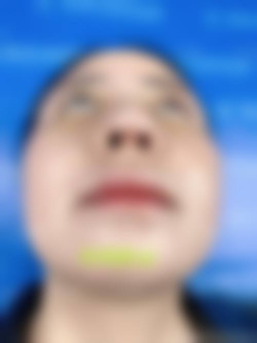 临床实例分享