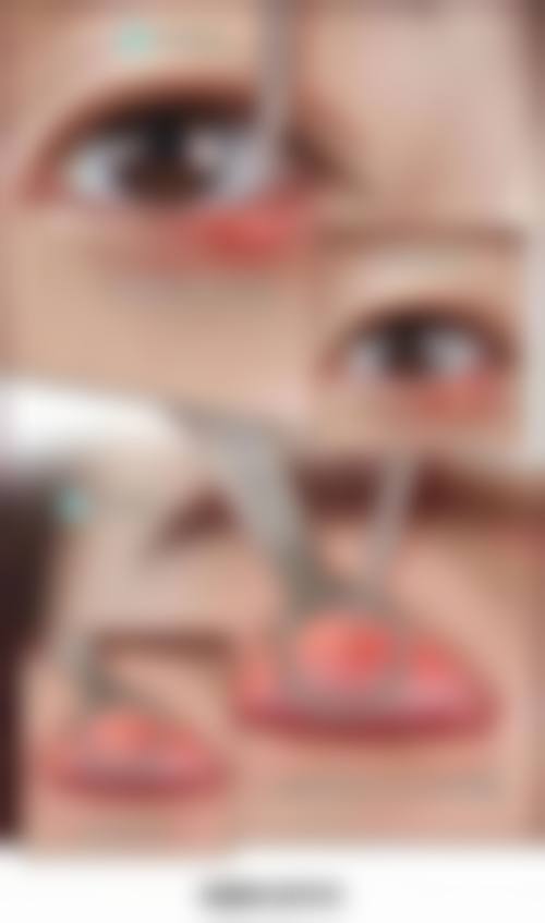 总结与预约指引