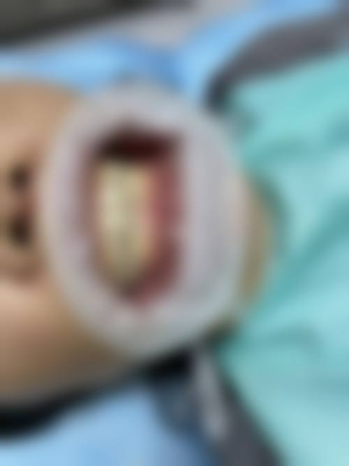 全链路口腔服务与个性化治疗方案