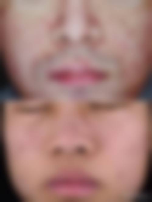 擅长项目详解