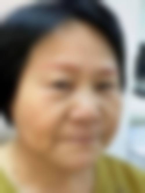 患者真实评价