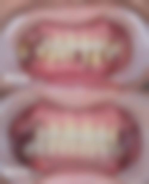 特色项目与价格:透明收费满足多元口腔需求