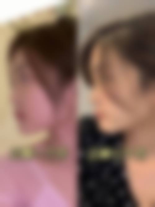 患者真实评价:长沙尚美口腔医院刘水英