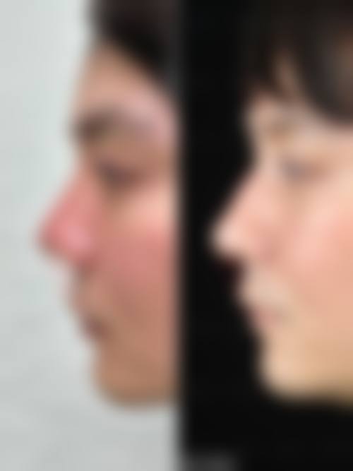 常见问题解答FAQ