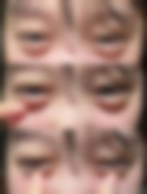 引进前列设备材料，保护治疗成效与安心