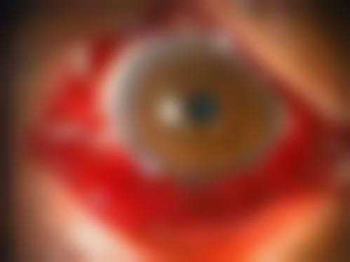 总结与预约:开启清晰视界新体验