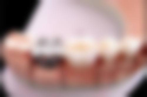 常见问题解答