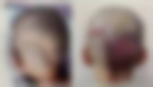 擅长项目详解：王世爽医生的核心技术领域