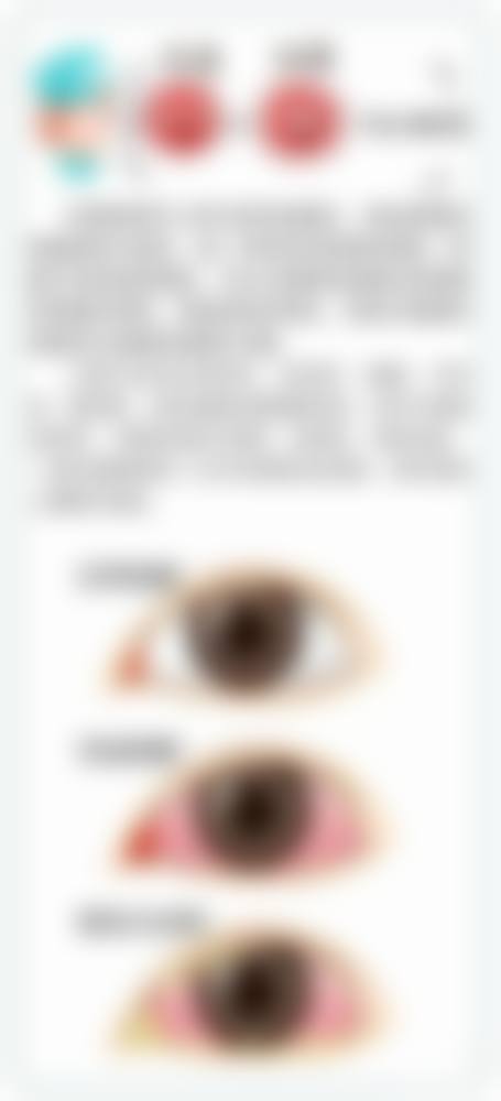 预约优惠活动