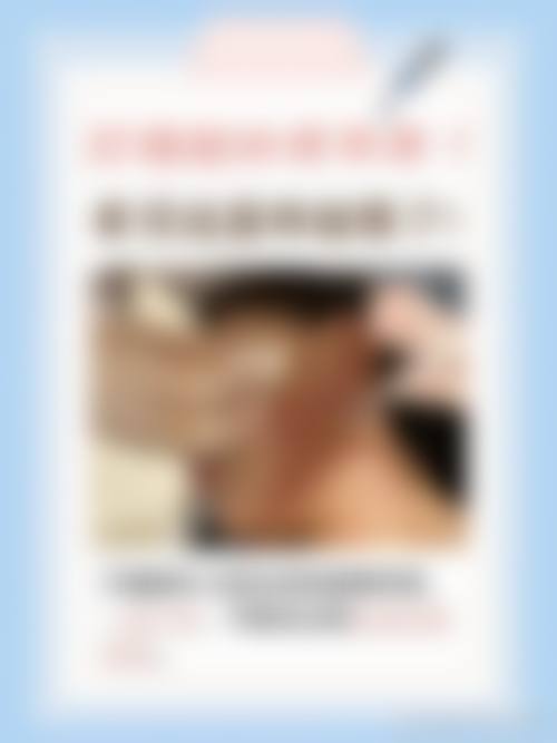 常见问题解答