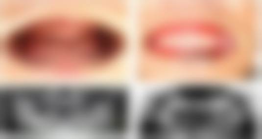 南京美奥口腔门诊部肖佳慧是否有失败案例？真实反馈揭秘，帮你避坑不踩雷！