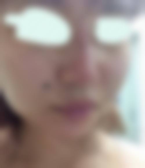 临床实例分享:李妍熹医生真实反馈