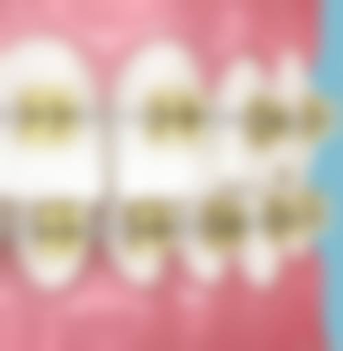 常见问题解答