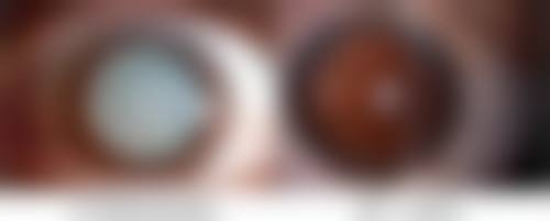 结尾预约号召:立即行动,重获清晰视界