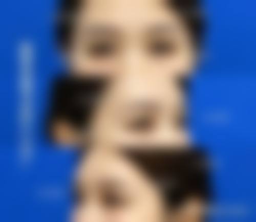 引进前列光电设备,精细解决皮肤难题