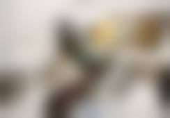 擅长项目详解:精细解决口腔问题