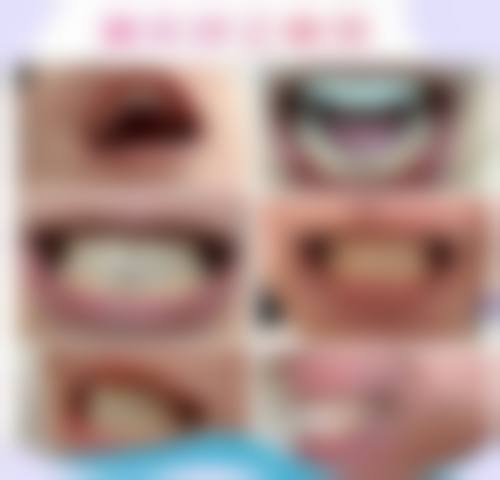 患者真实评价:了解贵阳君雅京恬口腔医院潘仁伟的口碑反馈