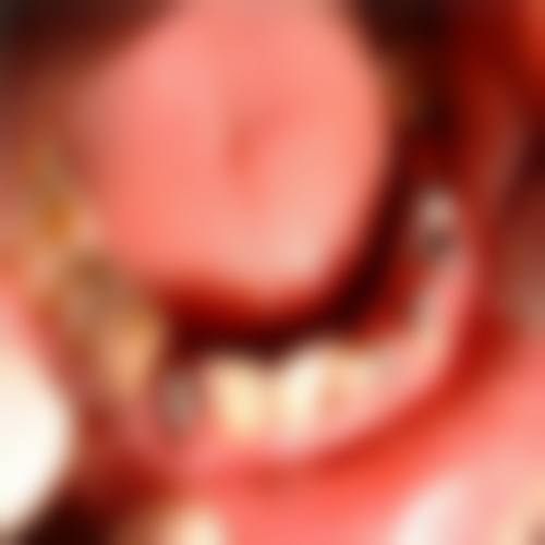预约优惠活动:获取贵阳君雅京恬口腔医院潘仁伟的专属补贴