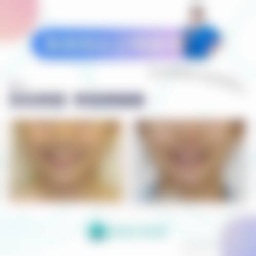 临床实例分享长春肤康医院顾学俊医生