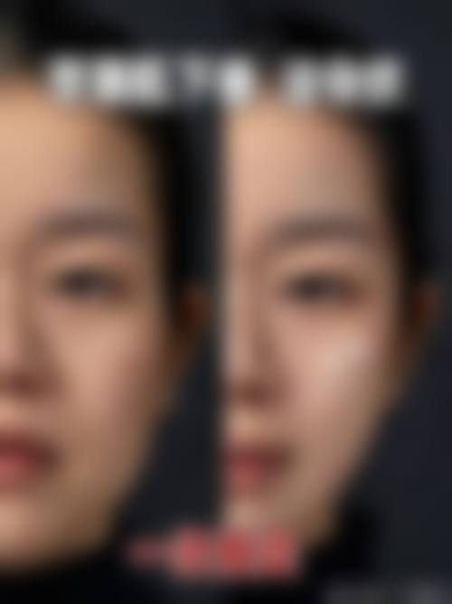 临床实例分享